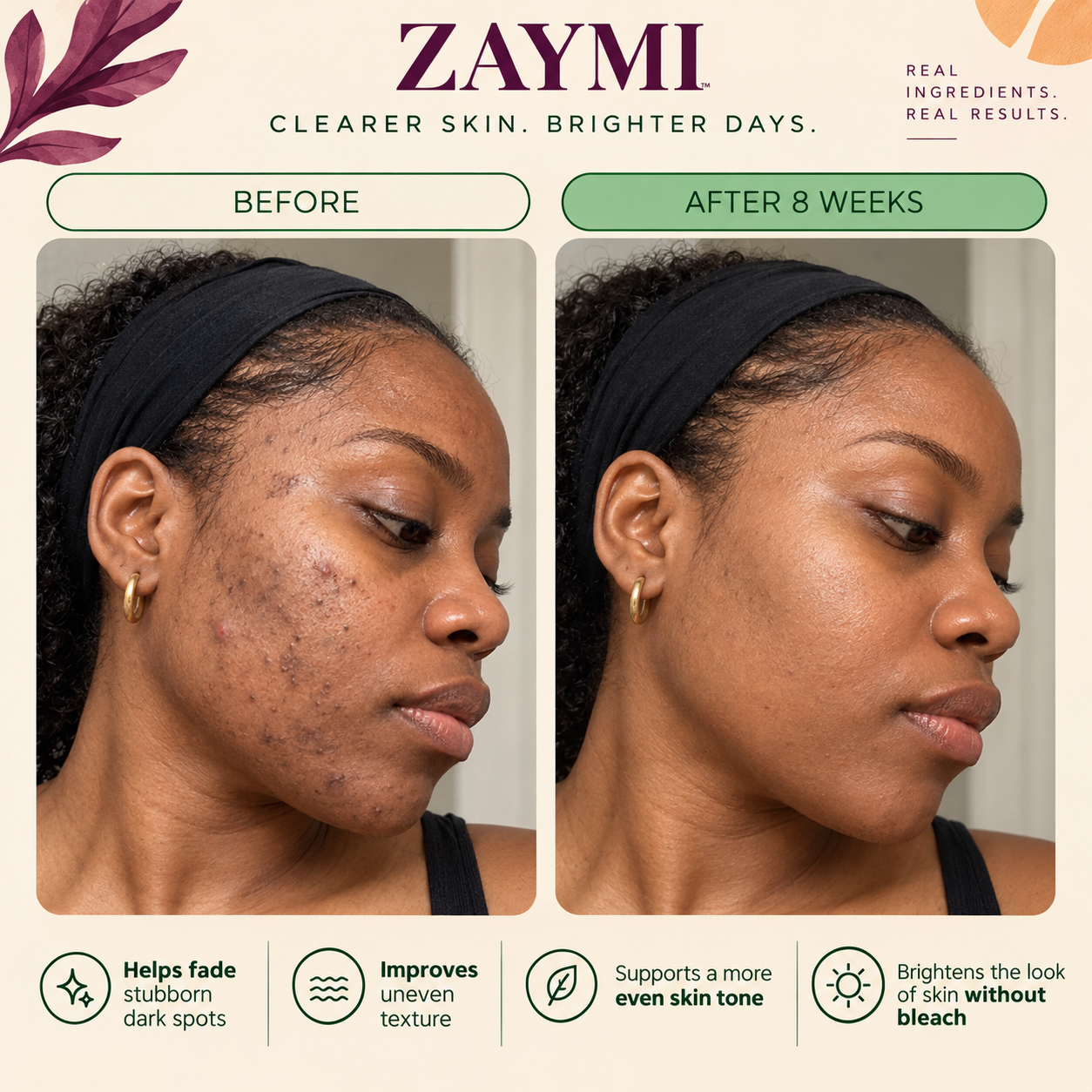 ZAYMI Turmeric Glow Bar