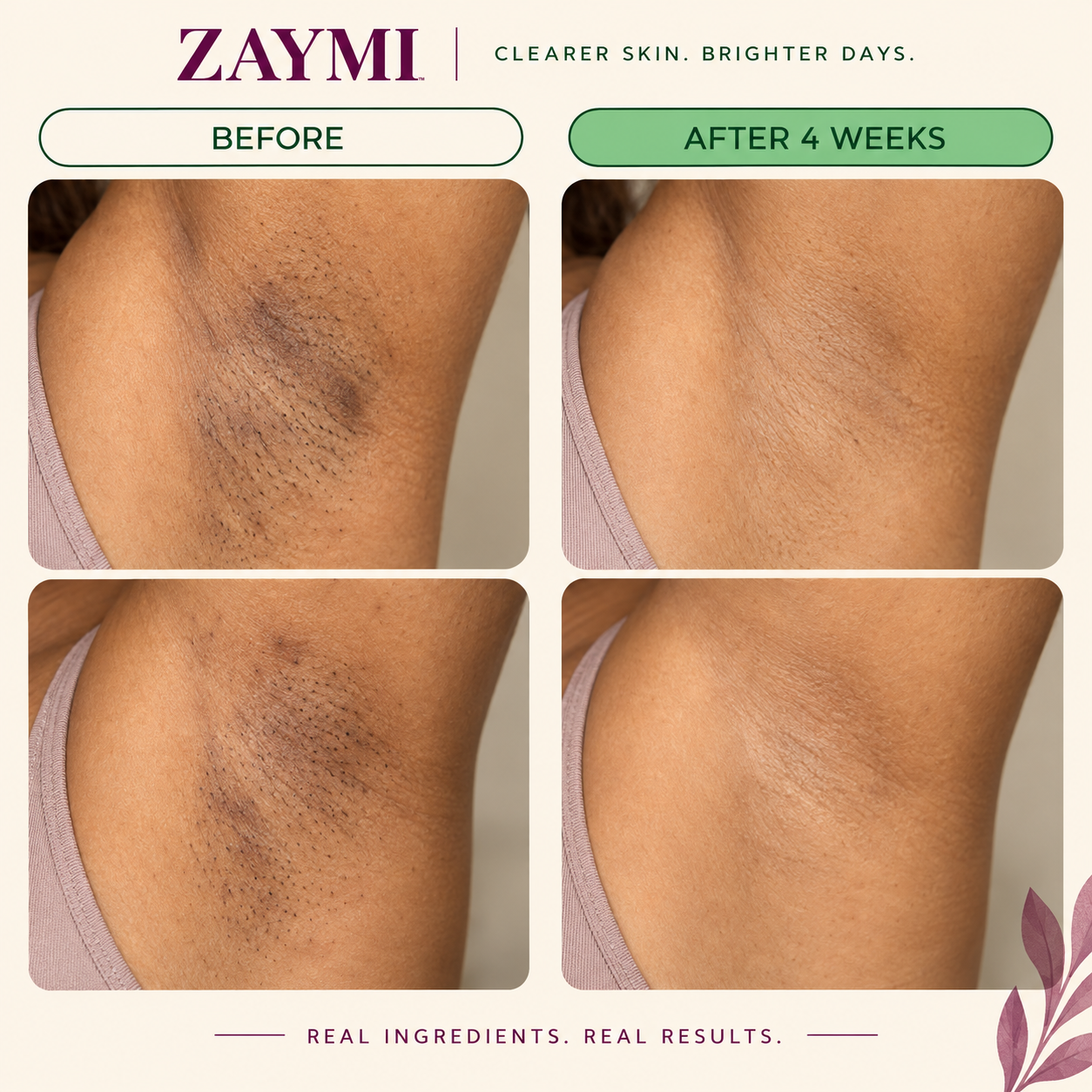 ZAYMI Turmeric Glow Bar